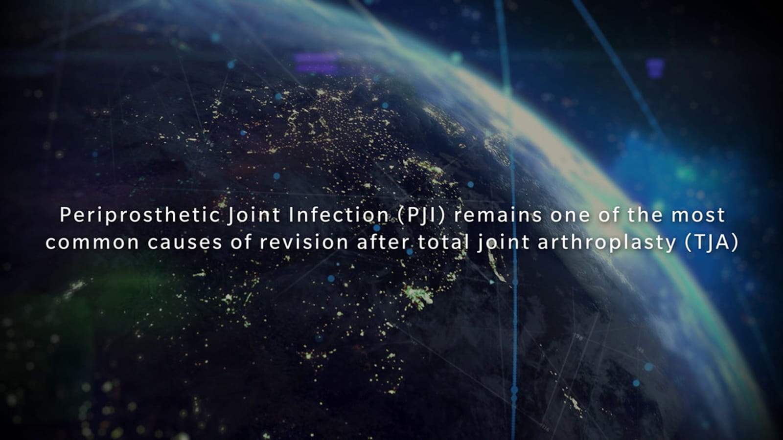 PJIに関する動画サムネイル
